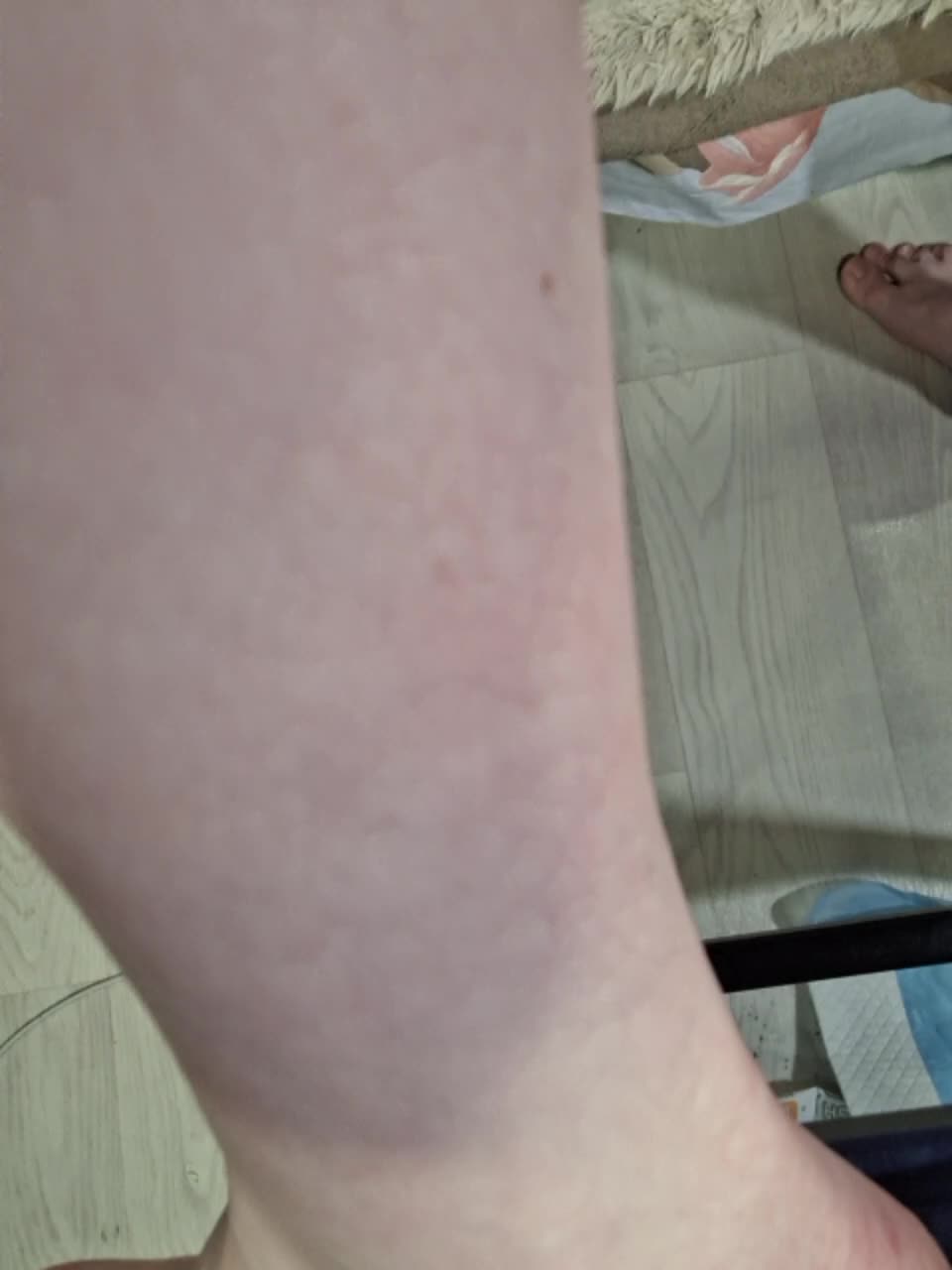 -scyrim- Приват Записи 2026-01-15